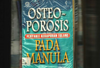 Osteoporosis Pada Manula